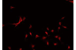 ABIN6269195 staining MCF-7 cells by IF/ICC.