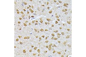 Immunohistochemistry of paraffin-embedded mouse brain using RPS27A antibody (ABIN3022728, ABIN3022729, ABIN1513489, ABIN1514633 and ABIN6219198) at dilution of 1:100 (40x lens). (RPS27A 抗体  (AA 1-156))