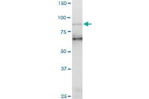 PCAF monoclonal antibody (M06), clone 5E5. (KAT2B 抗体  (AA 353-452))