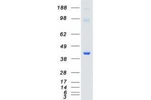 Validation with Western Blot