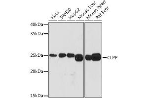 Western blot analysis of extracts of various cell lines, using CLPP Rabbit mAb (ABIN1682296, ABIN3017596, ABIN3017597 and ABIN7101508) at 1:1000 dilution. (CLPP 抗体)
