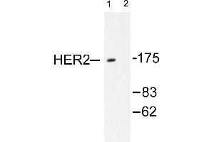 Image no. 1 for anti-Receptor tyrosine-protein kinase erbB-2 (ErbB2/Her2) antibody (ABIN265464) (ErbB2/Her2 抗体)