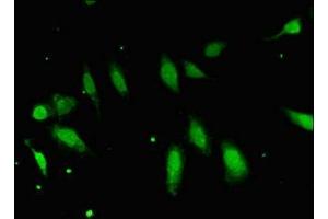 Immunofluorescent analysis of Hela cells using ABIN7152417 at dilution of 1:100 and Alexa Fluor 488-congugated AffiniPure Goat Anti-Rabbit IgG(H+L) (FBXO25 抗体  (AA 1-291))