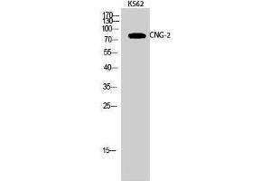 Western Blotting (WB) image for anti-Cyclic Nucleotide Gated Channel alpha 2 (CNGA2) (Internal Region) antibody (ABIN3174461) (CNGA2 抗体  (Internal Region))
