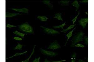 Immunofluorescence of monoclonal antibody to SFN on HeLa cell. (14-3-3 sigma/SFN 抗体  (AA 1-248))