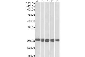Western Blotting (WB) image for anti-Casein Kinase 2, beta (CSNK2B) (AA 172-186) antibody (ABIN5886334) (CSNK2B 抗体  (AA 172-186))