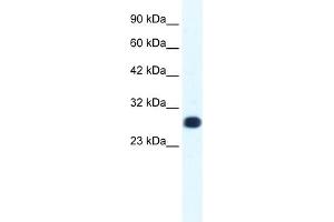 WB Suggested Anti-GTF2F2 Antibody Titration: 1. (GTF2F2 抗体  (Middle Region))