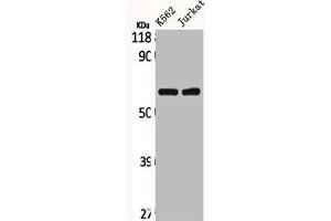 Western Blot analysis of K562 Jurkat cells using CLCC1 Polyclonal Antibody (CLCC1 抗体  (Internal Region))