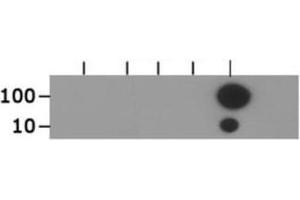 Dot Blot of Rabbit Histone H3 [ac Lys18] Antibody. (Histone 3 抗体  (H3K18ac))