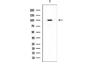 anti-Mannosyl (Alpha-1,6-)-Glycoprotein beta-1,6-N-Acetyl-Glucosaminyltransferase (MGAT5) antibody