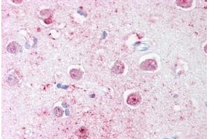 Human Brain, Cortex (formalin-fixed, paraffin-embedded) stained with LINGO1 antibody ABIN239799 at 20 ug/ml followed by biotinylated goat anti-rabbit IgG secondary antibody ABIN481713, alkaline phosphatase-streptavidin and chromogen. (LINGO1 抗体  (C-Term))