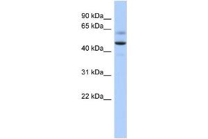 WB Suggested Anti-ARSA Antibody Titration: 0. (Arylsulfatase A 抗体  (Middle Region))