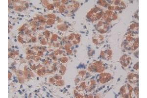 DAB staining on IHC-P; Samples: Human Stomach Tissue (GRF2 抗体  (AA 780-1035))