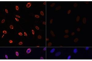 Immunofluorescence analysis of NIH/3T3 cells using Acetyl-Histone H3-K36 Polyclonal Antibody at dilution of 1:100. (Histone 3 抗体  (acLys36))