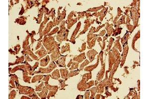Immunohistochemistry of paraffin-embedded human heart tissue using ABIN7146522 at dilution of 1:100 (CAPNL1 抗体  (Catalytic Subunit))