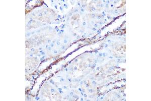 Immunohistochemistry (IHC) image for anti-Mitogen-Activated Protein Kinase Kinase Kinase 7 (MAP3K7) (AA 300-470) antibody (ABIN6143503)
