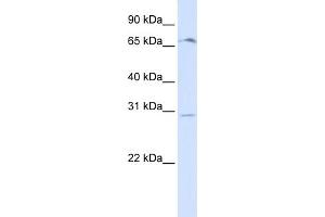 WB Suggested Anti-OR6C75 Antibody Titration:  0. (OR6C75 抗体  (Middle Region))