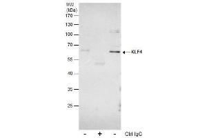 IP Image Immunoprecipitation of KLF4 protein from HeLa whole cell extracts using 5 μg of KLF4 antibody, Western blot analysis was performed using KLF4 antibody, EasyBlot anti-Rabbit IgG  was used as a secondary reagent. (KLF4 抗体  (C-Term))