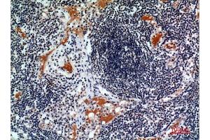 Immunohistochemistry (IHC) analysis of paraffin-embedded Human Lymph, it was diluted at 1:100.