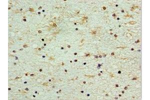 Immunohistochemistry of paraffin-embedded human brain tissue using ABIN7148846 at dilution of 1:100