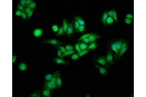Immunofluorescence staining of HepG2 cells with ABIN7146984 at 1:166, counter-stained with DAPI. (CTNNB1 抗体  (AA 2-781))