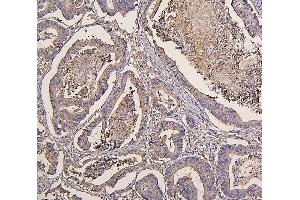IHC analysis of IRS1 using anti-IRS1 antibody (ABIN7599659).