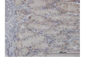 Immunoperoxidase of purified MaxPab antibody to PDHA1 on formalin-fixed paraffin-embedded human stomach. (PDHA1 抗体  (AA 1-390))