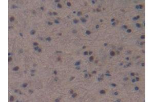 IHC-P analysis of Mouse Brain Tissue, with DAB staining. (NPPC 抗体  (AA 30-126))