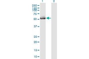 Western Blot analysis of IQCB1 expression in transfected 293T cell line by IQCB1 MaxPab polyclonal antibody. (IQCB1 抗体  (AA 1-465))