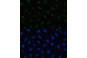 Immunofluorescence analysis of U2OS cells using HSF1 antibody (ABIN6131141, ABIN6142021, ABIN6142022 and ABIN6217875) at dilution of 1:100. (HSF1 抗体  (AA 350-529))