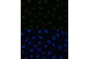 Immunofluorescence analysis of U2OS cells using HSF1 antibody (ABIN6131141, ABIN6142021, ABIN6142022 and ABIN6217875) at dilution of 1:100. (HSF1 抗体  (AA 350-529))