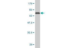 Western Blot detection against Immunogen (62. (PLAUR 抗体  (AA 1-335))
