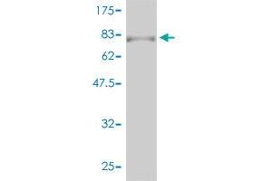 Western Blotting (WB) image for anti-Retinoic Acid Receptor, alpha (RARA) (AA 1-462) antibody (ABIN562584)