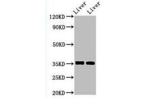 Western Blotting (WB) image for anti-Arginase, Liver (ARG1) (AA 1-322) antibody (ABIN6091459)