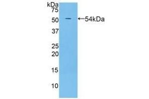Detection of Recombinant PZP, Rat using Polyclonal Antibody to Pregnancy Zone Protein (PZP) (PZP 抗体  (AA 1251-1500))
