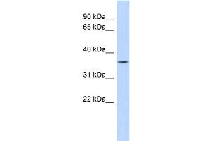 WB Suggested Anti-MMP23B Antibody Titration:  0.