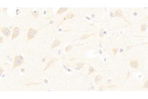 Immunohistochemistry (IHC) image for anti-Solute Carrier Family 1 (Neuronal/epithelial High Affinity Glutamate Transporter, System Xag), Member 1 (SLC1A1) (AA 115-209) antibody (ABIN7441163)