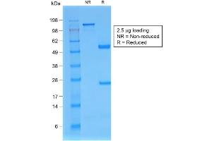 SDS-PAGE Analysis of Purified B2M Mouse Recombinant Monoclonal Antibody ABIN6383845.