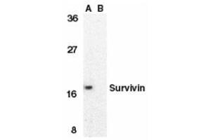 Western blot analysis of survivin in MOLT4 cell lysate in the absence (A) or presence (B) of blocking peptide with this product at 1 μg/ml. (Survivin 抗体  (C-Term))
