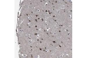 Immunohistochemical staining of human cerebral cortex with CCDC34 polyclonal antibody  shows moderate nuclear membrane positivity in neuronal cells at 1:500-1:1000 dilution. (CCDC34 抗体)