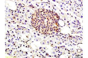 Immunohistochemistry (IHC) image for anti-Transforming Growth Factor beta Regulator 1 (TBRG1) (AA 28-130) antibody (ABIN706151)