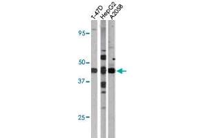 The E2F1 (phospho S337) polyclonal antibody  is used in Western blot to detect Phospho-E2F1-S337 in T-47D (left), HepG2 (middle), and A2058 (right) cell lysates (E2F1 抗体  (pSer337))