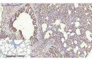 Immunohistochemical analysis of paraffin-embedded rat lung tissue. (PDGFB 抗体  (AA 30-110))