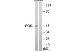 Western blot analysis of extracts from RAW264. (c-FOS 抗体  (AA 201-250))