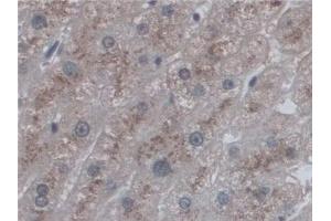 Detection of CD209 in Human Liver Tissue using Polyclonal Antibody to Cluster Of Differentiation 209 (CD209) (DC-SIGN/CD209 抗体  (AA 70-404))