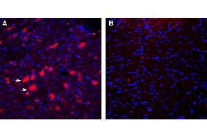 Expression of CD157 in rat deep cerebellar nuclei. (BST1 抗体  (Extracellular))