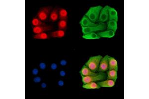 ABIN7095901 and ABIN7099963 staining Hela cells by IF/ICC. (MED13L 抗体)