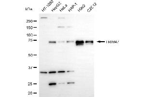 Western blotting analysis using TRIM47 antibody (ABIN7800635). (TRIM47 抗体)
