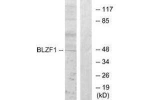 Western blot analysis of extracts from Jurkat cells, using BLZF1 Antibody. (BLZF1 抗体  (AA 10-59))