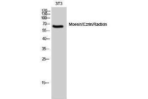 Western Blotting (WB) image for anti-Moesin/ezrin/radixin (Ser105) antibody (ABIN3185614) (Moesin/ezrin/radixin (Ser105) 抗体)